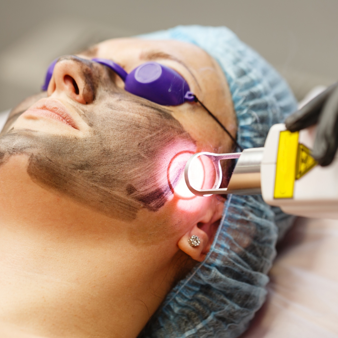 Home Laser